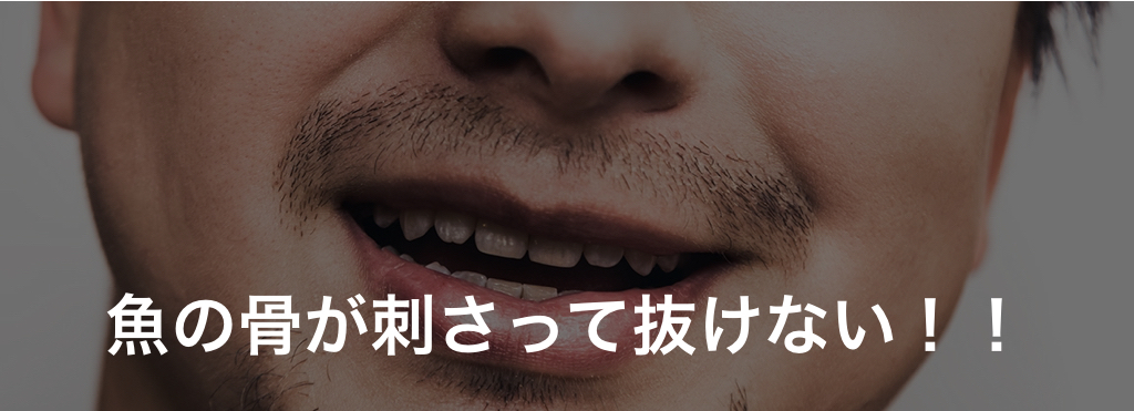 喉に刺さった魚の骨を自力で正しく抜き取る方法。〜ご飯ごっくんすべからず〜 img